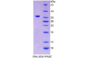 SDS-PAGE analysis of Guinea pig APOC2 Protein. (Apolipoprotein C-II Protein (APOC2))