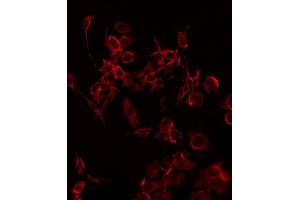 ABIN6268823 staining HuvEc by IF/ICC. (CD69 Antikörper  (Internal Region))
