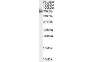 Western Blotting (WB) image for anti-Signal Transducer and Activator of Transcription 3 (Acute-Phase Response Factor) (STAT3) (Internal Region) antibody (ABIN2465310) (STAT3 Antikörper  (Internal Region))