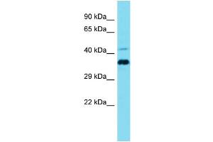 Host: Rabbit Target Name: CCDC137 Sample Type: Jurkat Whole Cell lysates Antibody Dilution: 1. (CCDC137 Antikörper  (N-Term))