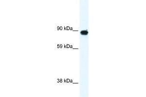 GRM6 antibody used at 0. (Metabotropic Glutamate Receptor 6 Antikörper  (C-Term))