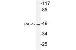 Western blot analysis of PAI-1 Antibody in extracts from Jurkat cells. (PAI1 Antikörper)