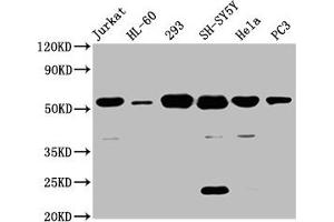 Western Blot Positive WB detected in: Jurkat whole cell lysate, HL60 whole cell lysate, 293 whole cell lysate, SH-SY5Y whole cell lysate, Hela whole cell lysate, PC-3 whole cell lysate All lanes: CYP21A2 antibody at 8 μg/mL Secondary Goat polyclonal to rabbit IgG at 1/50000 dilution Predicted band size: 56, 53 kDa Observed band size: 56 kDa (CYP21A2 Antikörper  (AA 312-418))