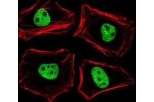 Fluorescent image of HeLa cells stained with TLE1 antibody diluted at 1:25 dilution.