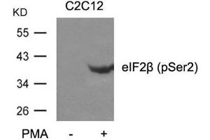 Western blot analysis of extracts from C2C12 cells untreated or treated with PMA using eIF2b(phospho-Ser2) Antibody. (EIF2S2 Antikörper  (pSer2))