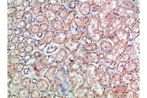 Immunohistochemistry (IHC) image for anti-CD3 epsilon (CD3E) (AA 31-80) antibody (ABIN7189485)
