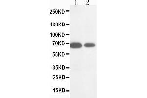 Anti-MMP16 antibody, Western blotting Lane 1: HELA Cell Lysate Lane 2: COLO320 Cell Lysate (MMP16 Antikörper  (C-Term))