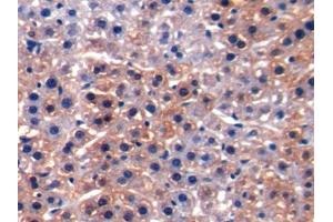DAB staining on IHC-P; Samples: Rat Liver Tissue (ALT Antikörper  (AA 203-443))
