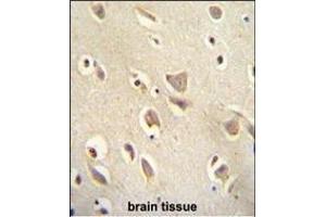 Immunohistochemistry (Paraffin-embedded Sections) (IHC (p)) image for anti-Melanin-Concentrating Hormone Receptor 1 (MCHR1) (AA 396-422), (C-Term) antibody (ABIN654645)