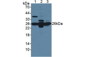 Western blot analysis of (1) Mouse Brain Tissue, (2) Mouse Liver Tissue and (3) Mouse Kidney Tissue. (GSTM1 Antikörper  (AA 1-218))