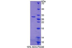 Image no. 1 for ATP-Binding Cassette, Sub-Family F (GCN20), Member 2 (ABCF2) (AA 396-623) protein (T7 tag,His tag) (ABIN6239299)