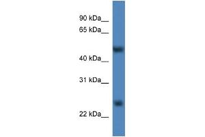 WB Suggested Anti-Mettl4 Antibody Titration:  0.