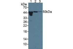 Western blot analysis of (1) Human Serum, (2) Rat Pancreas Tissue and (3) Rat Bladder Tissue. (ORM1 Antikörper  (AA 19-201))