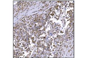 IHC analysis of LRP1B using anti-LRP1B antibody (ABIN7601521). (LRP1B Antikörper  (AA 3704-4547))
