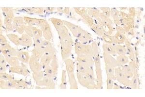 Detection of RARS in Human Cardiac Muscle Tissue using Monoclonal Antibody to Arginyl tRNA Synthetase (RARS) (RARS Antikörper  (AA 1-146))