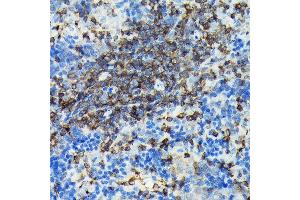 Immunohistochemistry of paraffin-embedded rat spleen using PIK3CG Rabbit pAb (ABIN6130600, ABIN6145638, ABIN6145639 and ABIN6222396) at dilution of 1:100 (40x lens). (PIK3 gamma Antikörper  (AA 1-200))