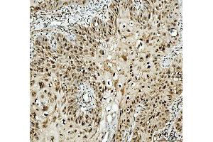 IHC analysis of SFPQ using anti-SFPQ antibody (ABIN7603089). (SFPQ Antikörper  (Middle Region))