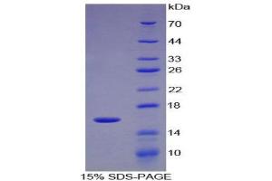 SDS-PAGE (SDS) image for UDP-Glucose Ceramide Glucosyltransferase (UGCG) protein (His tag) (ABIN1099559)