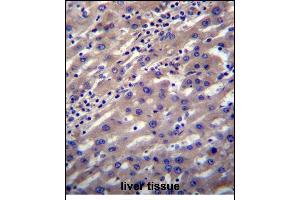 SCP2 Antibody (N-term) (ABIN656448 and ABIN2845733) immunohistochemistry analysis in formalin fixed and paraffin embedded human liver tissue followed by peroxidase conjugation of the secondary antibody and DAB staining. (SCP2 Antikörper  (N-Term))