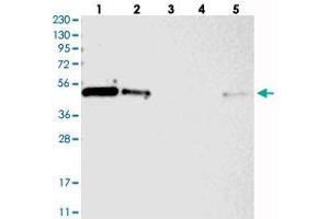 Western blot analysis of Lane 1: RT-4, Lane 2: U-251 MG, Lane 3: Human Plasma, Lane 4: Liver, Lane 5: Tonsil with ZNF787 polyclonal antibody  at 1:250-1:500 dilution. (ZNF787 Antikörper)