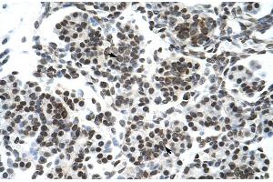 Rabbit Anti-ZNF394 Antibody Catalog Number: ARP30072 Paraffin Embedded Tissue: Human Pancreas Cellular Data: Epithelial cells of pancreatic acinus Antibody Concentration: 4. (ZNF394 Antikörper  (N-Term))