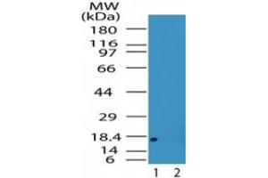 Image no. 1 for anti-Acid Phosphatase 1, Soluble (ACP1) (AA 40-80) antibody (ABIN200029) (ACP1 Antikörper  (AA 40-80))