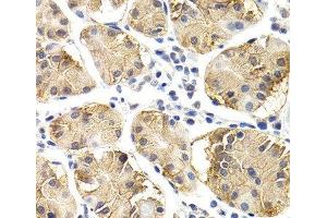 Immunohistochemistry of paraffin-embedded Human normal stomach using CHIT1 Polyclonal Antibody at dilution of 1:200 (40x lens). (Chitotriosidase 1 Antikörper)