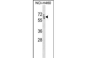 CYP4V2 Antibody (C-term) (ABIN1537408 and ABIN2849135) western blot analysis in NCI- cell line lysates (35 μg/lane).