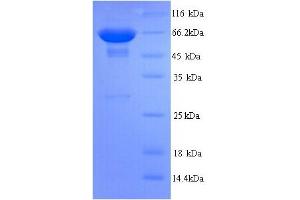 SDS-PAGE (SDS) image for Protein tyrosine Phosphatase, Receptor Type, C (PTPRC) (AA 24-575) protein (His tag) (ABIN5713770)