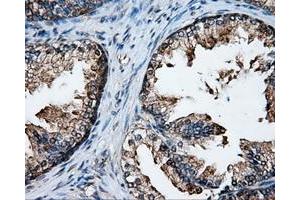 Immunohistochemical staining of paraffin-embedded Kidney tissue using anti-XRCC1mouse monoclonal antibody. (XRCC1 Antikörper)