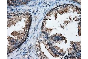 Immunohistochemical staining of paraffin-embedded Kidney tissue using anti-XRCC1mouse monoclonal antibody.