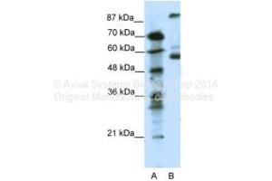 Host: Rabbit Target Name: HTR7 Sample Tissue: Human Jurkat Antibody Dilution: 1ug/ml (HTR7 Antikörper  (N-Term))