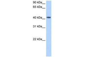 Image no. 1 for anti-Pregnancy Specific beta-1-Glycoprotein 5 (PSG5) (AA 71-120) antibody (ABIN204983) (PSG5 Antikörper  (AA 71-120))