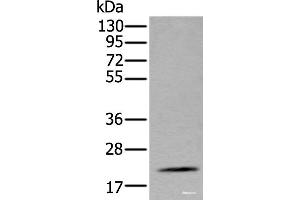Western blot analysis of Mouse fat tissue lysate using ZFAND5 Polyclonal Antibody at dilution of 1:500 (ZFAND5 Antikörper)