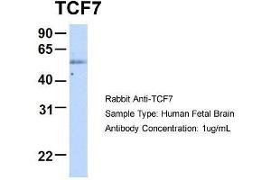 Host:  Rabbit  Target Name:  TCF7  Sample Type:  Human Fetal Brain  Antibody Dilution:  1. (TCF7 Antikörper  (Middle Region))