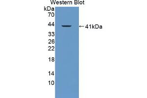 Western blot analysis of the recombinant protein. (FAM19A3 Antikörper  (AA 30-129))