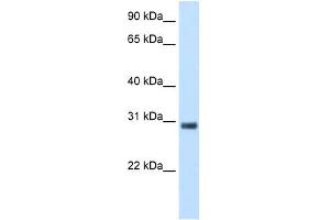 KCTD6 antibody used at 5 ug/ml to detect target protein.