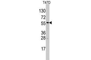 Western blot analysis of ALDH6A1 polyclonal antibody  in T-47D cell line lysates (35 ug/lane). (ALDH6A1 Antikörper  (N-Term))