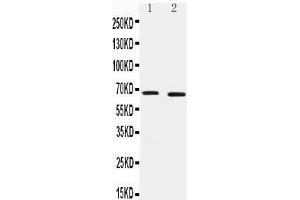 Anti-IRAKM antibody,  Western blotting Lane 1: HELA Cell Lysate Lane 2: JURKAT Cell Lysate (IRAK3 Antikörper  (C-Term))