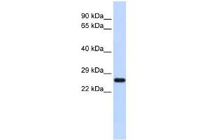 SOD2 antibody used at 1 ug/ml to detect target protein. (SOD2 Antikörper  (N-Term))