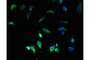 Immunofluorescent analysis of U251 cells using ABIN7149126 at dilution of 1:100 and Alexa Fluor 488-congugated AffiniPure Goat Anti-Rabbit IgG(H+L) (UBXN11 Antikörper  (AA 38-146))