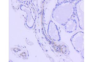 Immunohistochemistry of paraffin-embedded human thyroid using ROCK1 antibody (ABIN4905028) at dilution of 1:100 (40x lens).