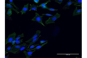 Immunofluorescence of monoclonal antibody to TLN1 on HeLa cell. (TLN1 Antikörper  (AA 1324-1424))