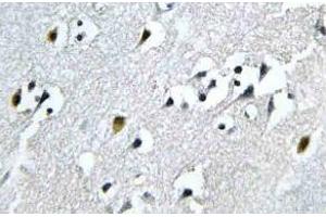 Immunohistochemistry (IHC) analyzes of N4BP1 antibody in paraffin-embedded human brain tissue. (N4BP1 Antikörper)
