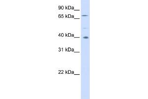 WB Suggested Anti-SPATA7 Antibody Titration: 0. (SPATA7 Antikörper  (Middle Region))