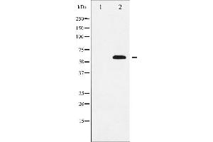 Western blot analysis of SOX9 expression in NIH-3T3 whole cell lysates,The lane on the left is treated with the antigen-specific peptide. (SOX9 Antikörper)