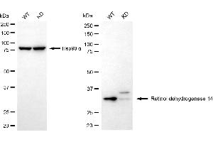 Western blotting analysis using retinol dehydrogenase 14 antibody (ABIN7800192).