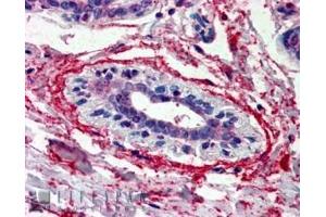 Image no. 3 for anti-Wingless-Type MMTV Integration Site Family, Member 3 (WNT3) (Internal Region) antibody (ABIN185634)