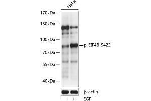 Western blot analysis of extracts of HeLa cells, using Phospho-EIF4B-S422 antibody (ABIN6135212, ABIN6136060, ABIN6136061 and ABIN6225673) at 1:2000 dilution. (EIF4B Antikörper  (pSer422))