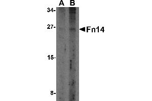 Western Blotting (WB) image for anti-Tumor Necrosis Factor Receptor Superfamily, Member 12A (TNFRSF12A) antibody (ABIN1031803) (TNFRSF12A Antikörper)